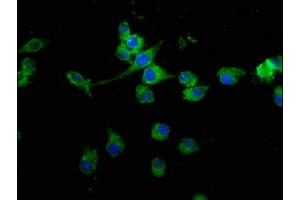 Immunofluorescence staining of SH-SY5Y cells with ABIN7159108 at 1:100, counter-stained with DAPI. (MED15 antibody  (AA 433-530))