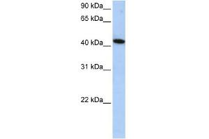 WB Suggested Anti-ICA1L Antibody Titration: 0. (ICA1L antibody  (Middle Region))