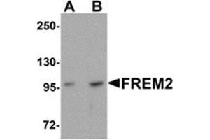 Western blot analysis of FREM2 in A-20 cell lysate with FREM2 antibody at (A) 0. (FREM2 antibody  (Center))