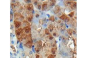 Used in DAB staining on fromalin fixed paraffin-embedded Kidney tissue (Adrenomedullin antibody  (AA 24-171))