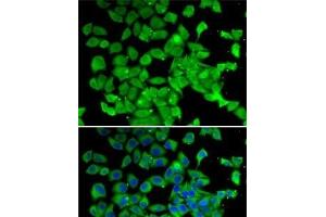 Immunofluorescence analysis of MCF7 cells using PARN Polyclonal Antibody (PARN antibody)