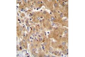 Formalin fixed and paraffin embedded human liver tissue reacted with GGH Antibody (N-term) followed by peroxidase conjugation of the secondary antibody and DAB staining. (GGH antibody  (N-Term))
