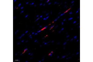 Immunofluorescence of paraffin embedded rat heart using MTND5 (ABIN7074659) at dilution of 1: 400 (400x lens) (MT-ND5 antibody)