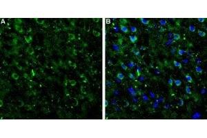 Expression of mGluR7 in rat neocortex - Immunohistochemical staining of rat neocortex frozen sections using Anti-mGluR7 (extracellular) Antibody (ABIN7043255, ABIN7044346 and ABIN7044347). (GRM7 antibody  (Extracellular, N-Term))