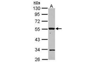 Image no. 2 for anti-Purinergic Receptor P2X, Ligand Gated Ion Channel 2 (P2RX2) (AA 8-302) antibody (ABIN1499950) (P2RX2 antibody  (AA 8-302))
