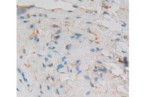 Used in DAB staining on fromalin fixed paraffin- embedded Kidney tissue (PCM1 antibody  (AA 1913-2024))