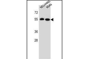 LRRC6 Antibody (Center) (ABIN655700 and ABIN2845153) western blot analysis in NCI-,A549 cell line lysates (35 μg/lane).