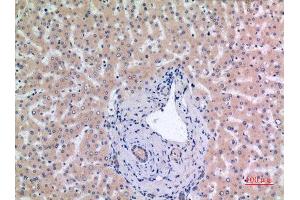 Immunohistochemistry (IHC) image for anti-Minichromosome Maintenance Complex Component 7 (MCM7) (Internal Region) antibody (ABIN3187879)