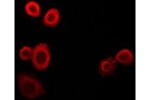 Immunofluorescent analysis of NDUFS4 staining in HepG2 cells. (NDUFS4 antibody)