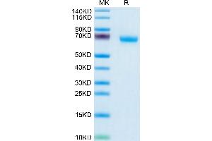 Human NKp46 on Tris-Bis PAGE under reduced condition. (NCR1 Protein (AA 22-255) (Fc Tag))