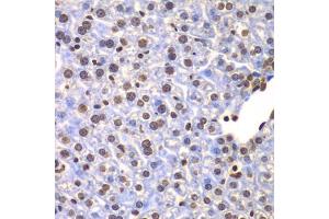 Immunohistochemistry of paraffin-embedded mouse liver using ULK4 antibody (ABIN5975557) at dilution of 1/100 (40x lens). (ULK4 antibody)