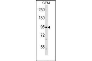 Western blot analysis of FAM38B Antibody (C-term) in CEM cell line lysates (35ug/lane). (PIEZO2 antibody  (C-Term))