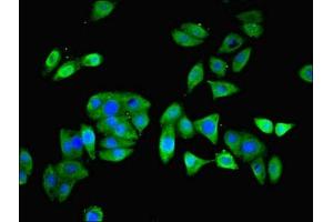 Immunofluorescent analysis of HepG2 cells using ABIN7164219 at dilution of 1:100 and Alexa Fluor 488-congugated AffiniPure Goat Anti-Rabbit IgG(H+L) (PFDN5 antibody  (AA 2-154))