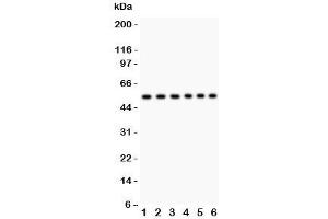 Western blot testing of CD8 antibody and Lane 1:  Jurkat;  2: Raji;  3: HL-60;  4: A549;  5: COLO320;  6: HeLa lysate;  Predicted size: 34KD;  Observed size: 34~60KD depending on glycosylation level