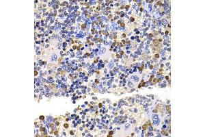 Immunohistochemistry of paraffin-embedded rat spleen using UBE2V2 antibody (ABIN5975744) at dilution of 1/100 (40x lens). (UBE2V2 antibody)