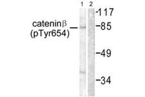 Western blot analysis of extracts from 293 cells, using Catenin-beta (Phospho-Tyr654) Antibody. (beta Catenin antibody  (pTyr654))