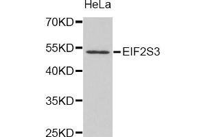 Western blot analysis of extracts of HeLa cell line, using EIF2S3 antibody.