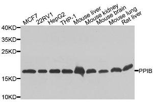 Western blot analysis of extracts of various cell lines, using PPIB antibody. (PPIB antibody  (AA 34-216))