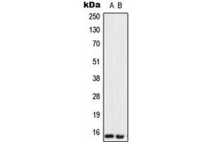 Western blot analysis of Urotensin 2 expression in SKBR3 (A), U251MG (B) whole cell lysates. (Urotensin 2 antibody  (Center))