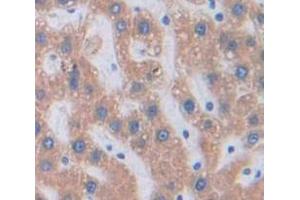 Figure. (SFRP4 antibody  (AA 167-260))