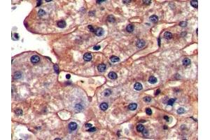 Immunohistochemistry (IHC) image for anti-Intercellular Adhesion Molecule 1 (ICAM1) (AA 27-209) antibody (ABIN7431974)