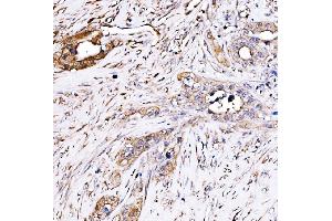 IHC analysis of PAK2 using anti-PAK2 antibody (ABIN7599219).
