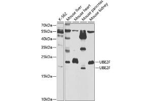 Western blot analysis of extracts of various cell lines, using UBE2F antibody  at 1:1000 dilution. (UBE2F antibody  (AA 1-185))