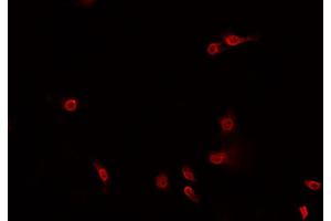 ABIN6269260 staining HeLa? (JNK antibody)