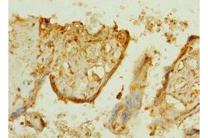 Immunohistochemistry of paraffin-embedded human placenta tissue using ABIN7164617 at dilution of 1:100 (TTLL2 antibody  (AA 401-592))