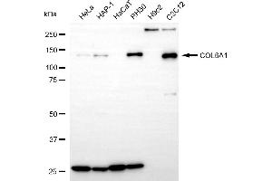Western blotting analysis using COL6A1 antibody (ABIN7798127).