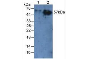 Western blot analysis of (1) Rat Liver Tissue and (2) Rat Skin Tissue. (CEACAM1 antibody  (AA 35-143))