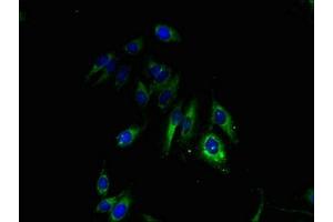 Immunofluorescent analysis of Hela cells using ABIN7153613 at dilution of 1:100 and Alexa Fluor 488-congugated AffiniPure Goat Anti-Rabbit IgG(H+L)