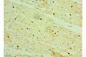 Immunohistochemistry of paraffin-embedded human heart tissue using ABIN7154911 at dilution of 1:100 (HSPB2 antibody  (AA 1-182))
