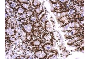 Immunohistochemistry (IHC) image for anti-Small Nuclear Ribonucleoprotein Polypeptide A (SNRPA) (C-Term) antibody (ABIN2855118)