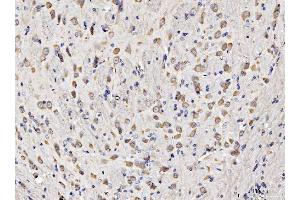 IHC analysis of RPL11 using anti-RPL11 antibody (ABIN7602315).