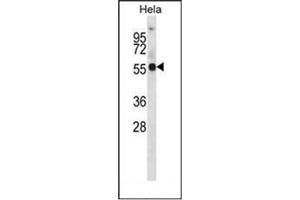 Western blot analysis of KCNA1 Antibody (Center) in Hela cell line lysates (35ug/lane).