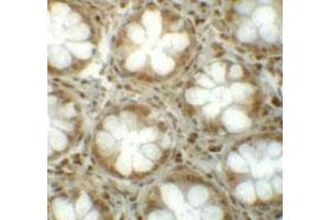 Immunohistochemical staining of human colon cells with LRRFIP1 polyclonal antibody  at 5 ug/mL. (LRRFIP1 antibody  (C-Term))