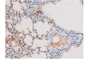 Immunohistochemistry (IHC) image for anti-Nuclear Factor-kB p65 (NFkBP65) (pThr435) antibody (ABIN6255688)