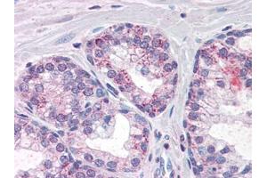 Image no. 1 for anti-phosphodiesterase 11A (PDE11A) (Internal Region) antibody (ABIN372893) (PDE11A antibody  (Internal Region))