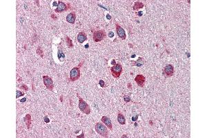 Anti-SERPINI1 / Neuroserpin antibody IHC of human brain, cortex. (Neuroserpin antibody  (AA 17-411))