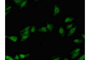Immunofluorescent analysis of Hela cells using ABIN7150259 at dilution of 1:100 and Alexa Fluor 488-congugated AffiniPure Goat Anti-Rabbit IgG(H+L) (POLL antibody  (AA 16-211))