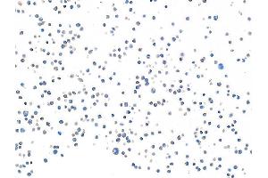 Immunocytochemistry (ICC) image for anti-CD28 (CD28) (AA 170-220) antibody (ABIN7455122) (Recombinant CD28 antibody  (AA 170-220))