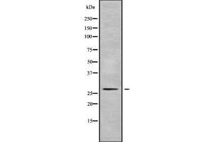 Western blot analysis of PEX11A using LOVO whole cell lysates
