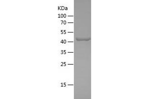 KAT2B Protein (AA 1864-2068) (His-IF2DI Tag)