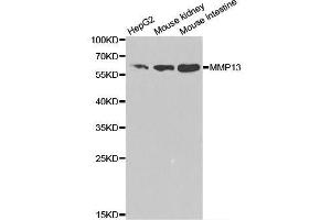Western blot analysis of extracts of various cell lines, using MMP13 antibody. (MMP13 antibody  (AA 262-471))
