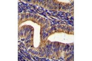 Immunohistochemistry analysis in formalin fixed and paraffin embedded human uterus tissue reacted with Ghrelin receptor / GHSR Antibody (C-term) followed by peroxidase conjugation of the secondary antibody and DAB staining. (GHSR antibody  (C-Term))