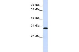 WB Suggested Anti-RPA4 Antibody Titration: 0. (RPA4 antibody  (C-Term))