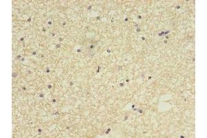 Immunohistochemistry of paraffin-embedded human brain tissue using ABIN7148084 at dilution of 1:100 (CCDC134 antibody  (AA 23-229))