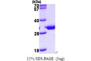 SDS-PAGE (SDS) image for Phosphomannomutase 2 (PMM2) (AA 1-246) protein (His tag) (ABIN667222)