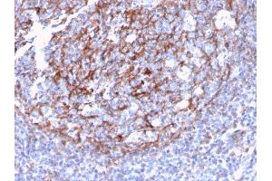 Formalin-fixed, paraffin-embedded human Tonsil Dendritic stained with CD21 / CR2 Recombinant Rabbit Monoclonal Antibody (CR2/3124R). (Recombinant CD21 antibody  (AA 142-240))